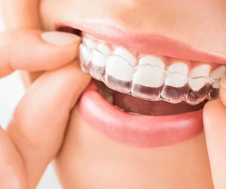 bop BRACES-Braces Orthodontics Pediatrics Invisalign Clear Braces