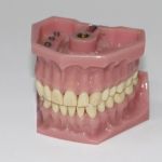 Emergency Dental Help