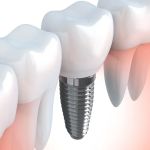 Northland Family Dentistry