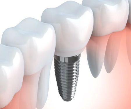Northland Family Dentistry
