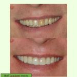 Forest Ridge Family Dentistry