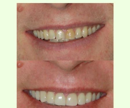 Forest Ridge Family Dentistry