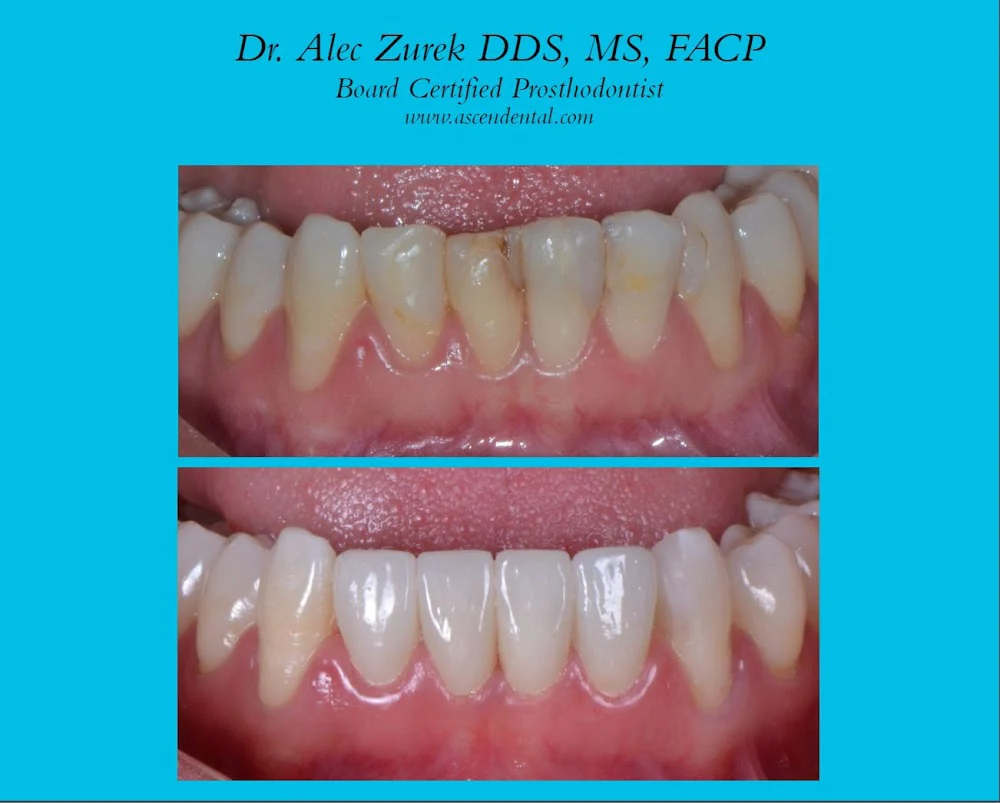 Ascend Dental - Dr. Zurek and Dr. Sikora 7