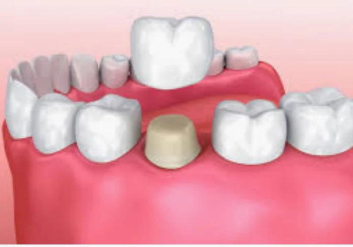 Smile Obsession Dental 10