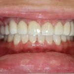 Northwest Implant Dental Spa