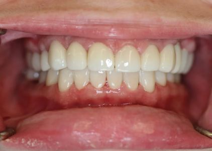 Northwest Implant Dental Spa