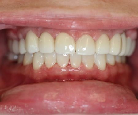 Northwest Implant Dental Spa