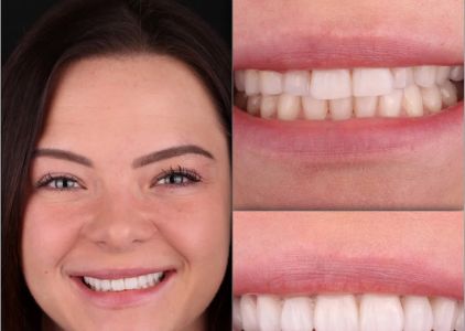 Greater Long Island Dental