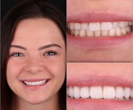 Greater Long Island Dental