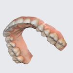 Family Dentistry - West End