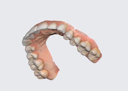 Family Dentistry - West End