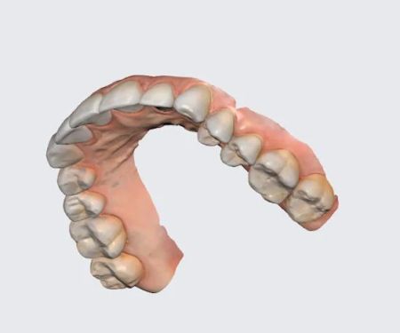 Family Dentistry - West End