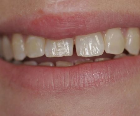 Michael Errico & Associates DDS