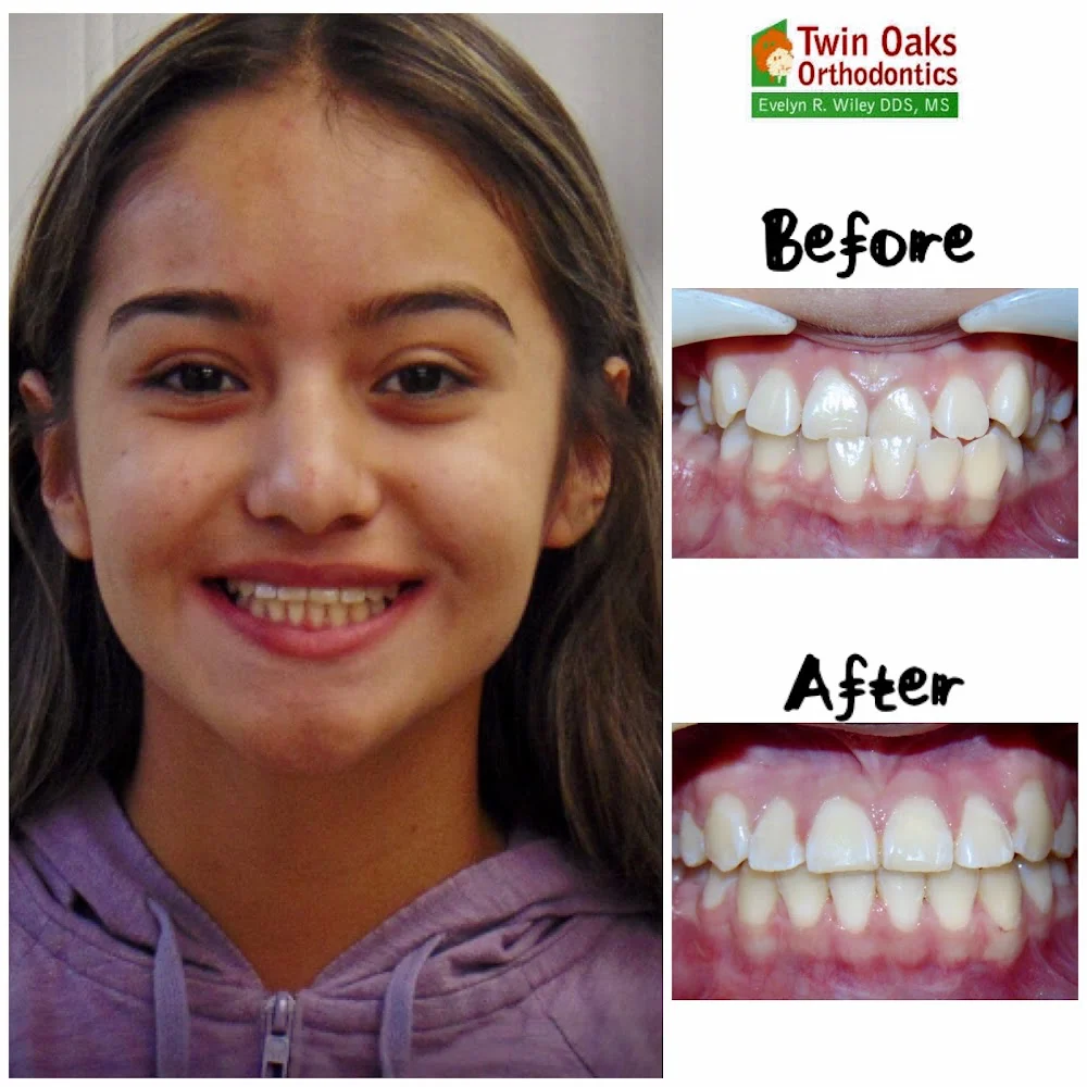 Twin Oaks Orthodontics 10