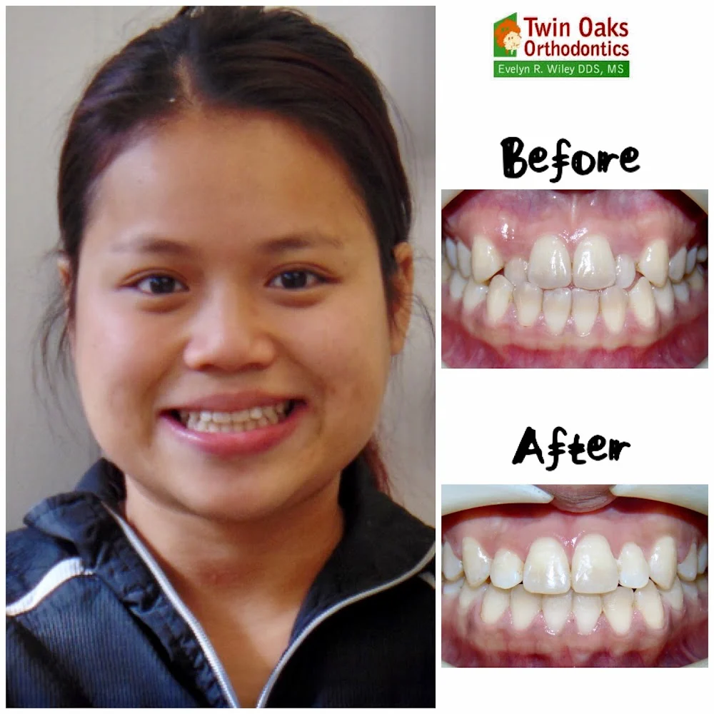 Twin Oaks Orthodontics 9