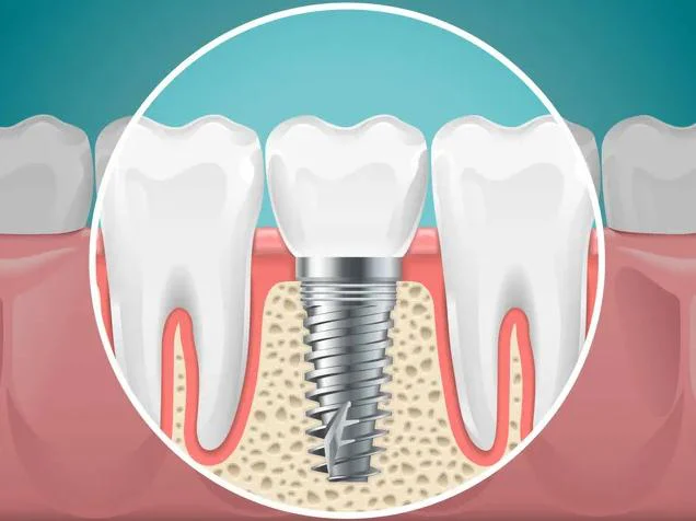 Puyallup Valley Dental Care 9