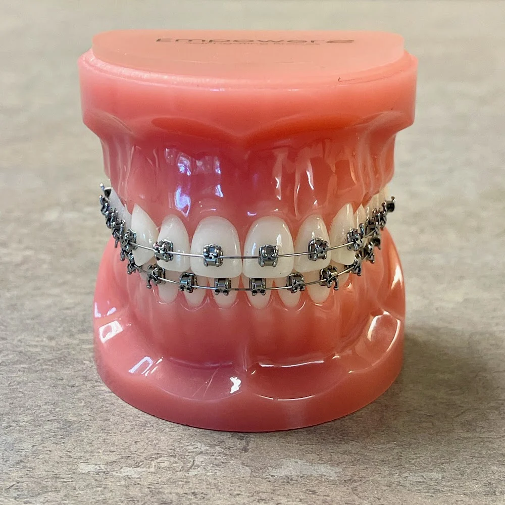 Proctor Braces 6