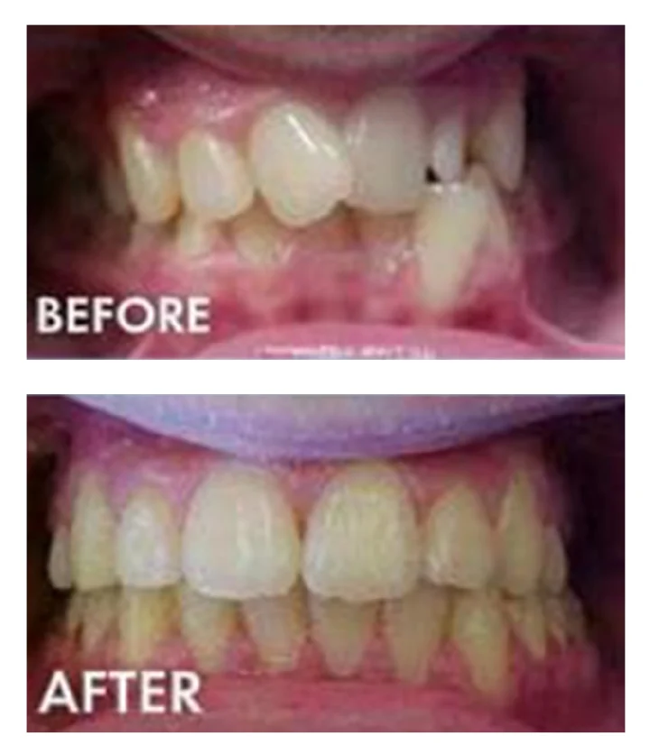 Cool Smiles Orthodontics - Colton Picture 9