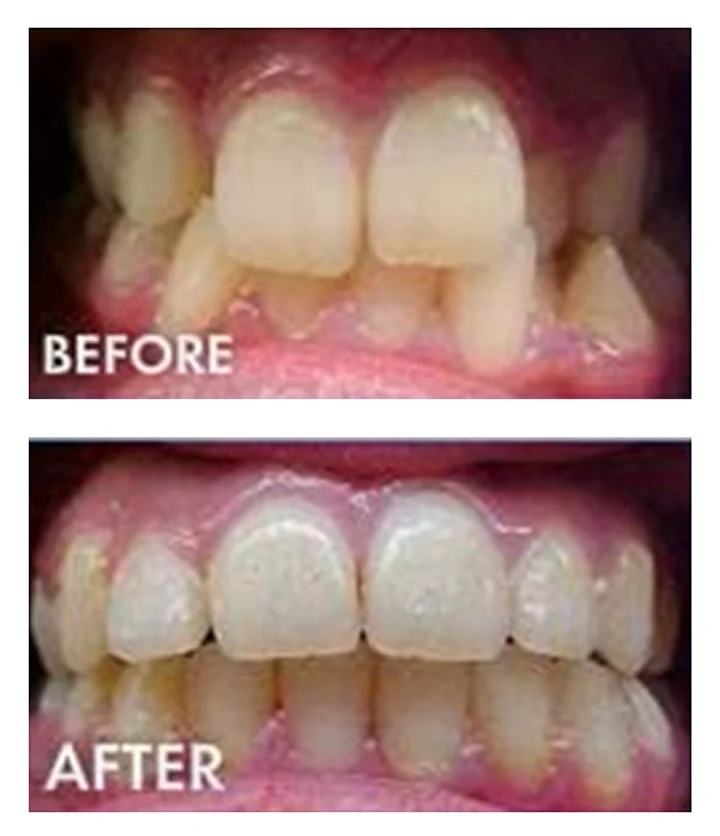 Cool Smiles Orthodontics - Colton Picture 8