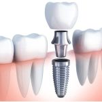 Abbey Dental, Inc.