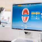 Dental Crown in an Hour: Naples