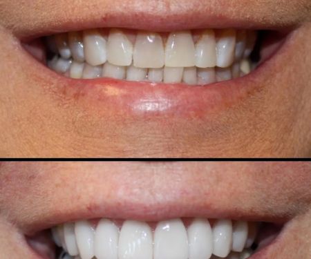 Aesthetic Dentistry at Bayfront