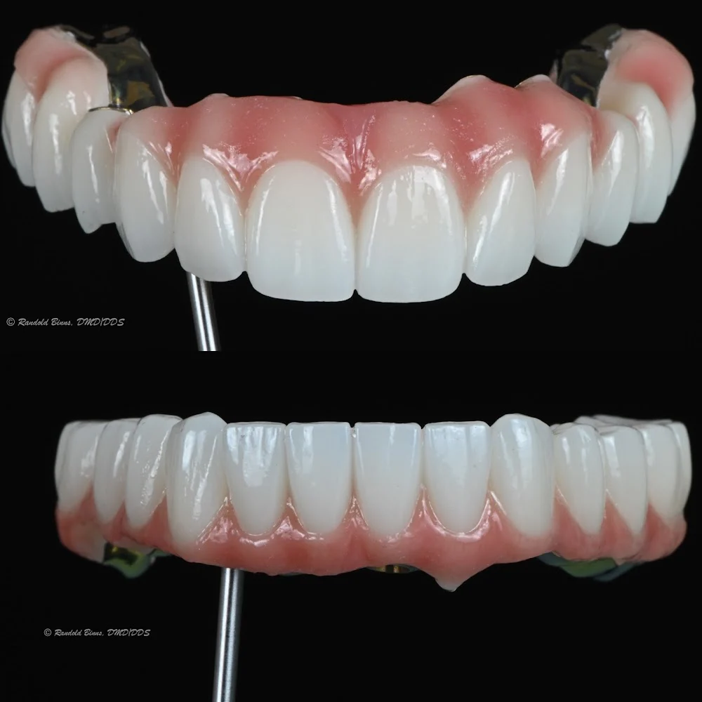 Advanced Prosthodontics & Implant Esthetics 2