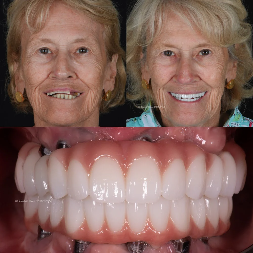 Advanced Prosthodontics & Implant Esthetics 5