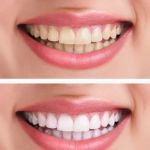 Ideal Dentistry