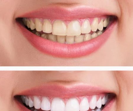 Ideal Dentistry