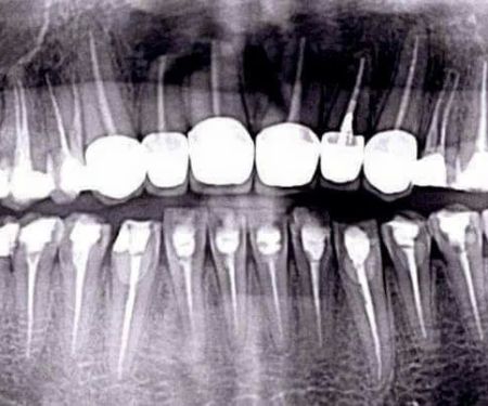 Shih Kingstone C DDS, Practice Limited to Endodontics
