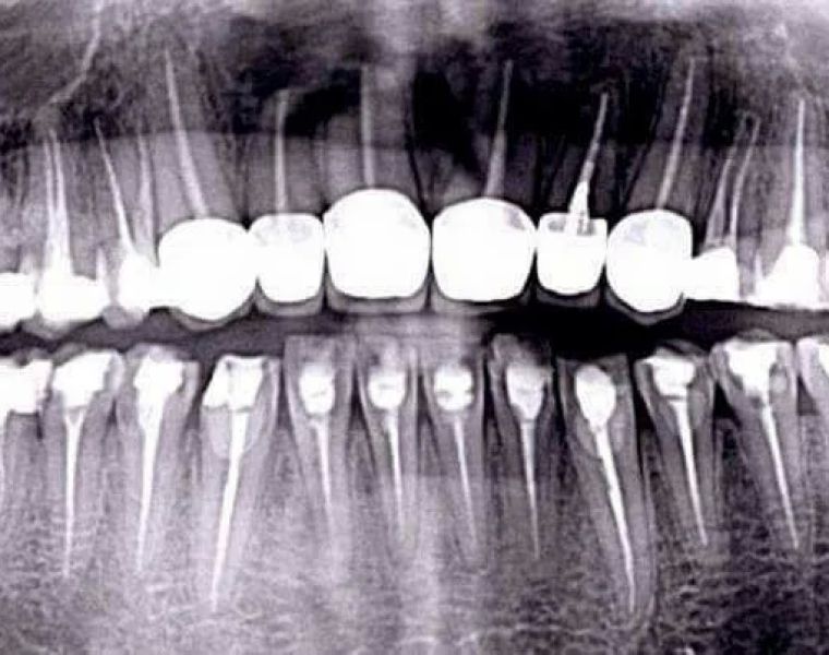 Shih Kingstone C DDS, Practice Limited to Endodontics