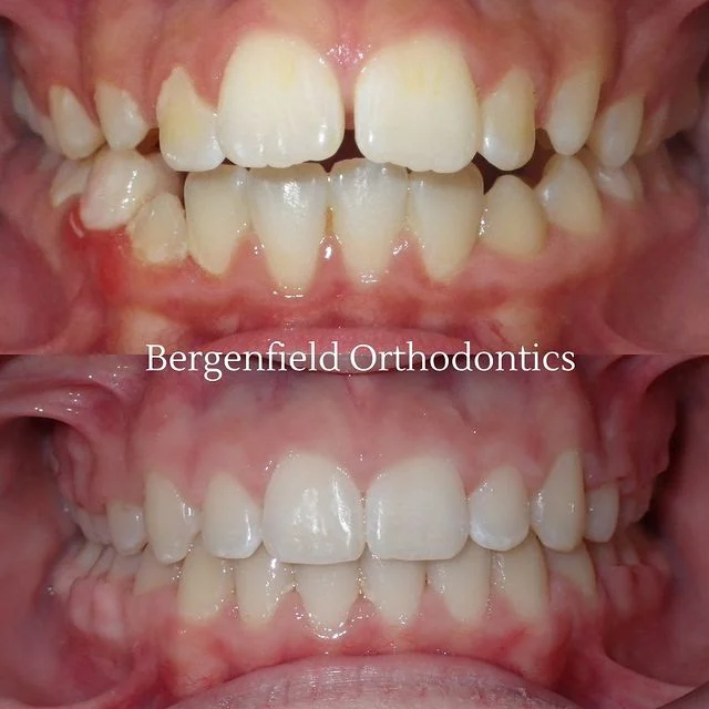 Bergenfield Orthodontics 10