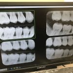Elite Dental - Allegheny