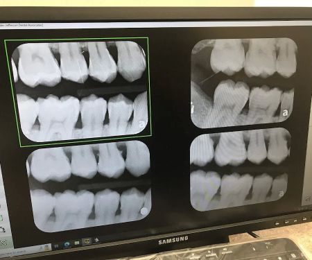 Elite Dental - Allegheny