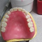 Affordable Dentures & Implants