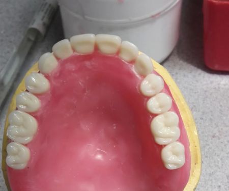 Affordable Dentures & Implants