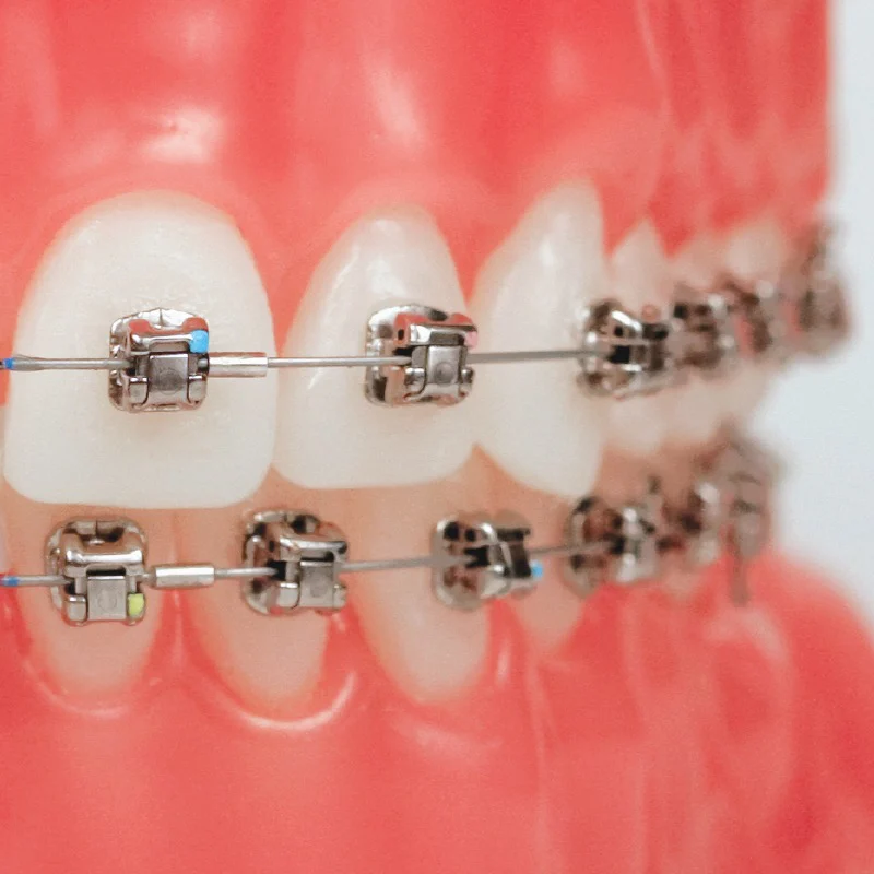 Associated Orthodontists - Plainfield 6