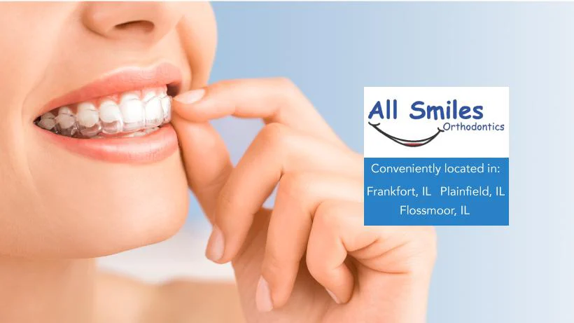 All Smiles Orthodontics 3