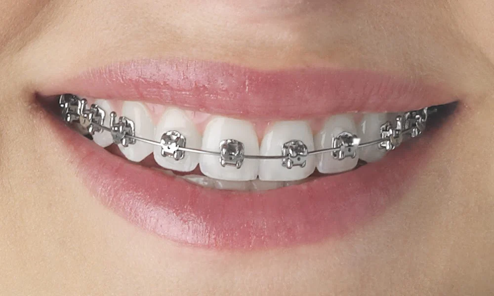 Verbic Orthodontics 7