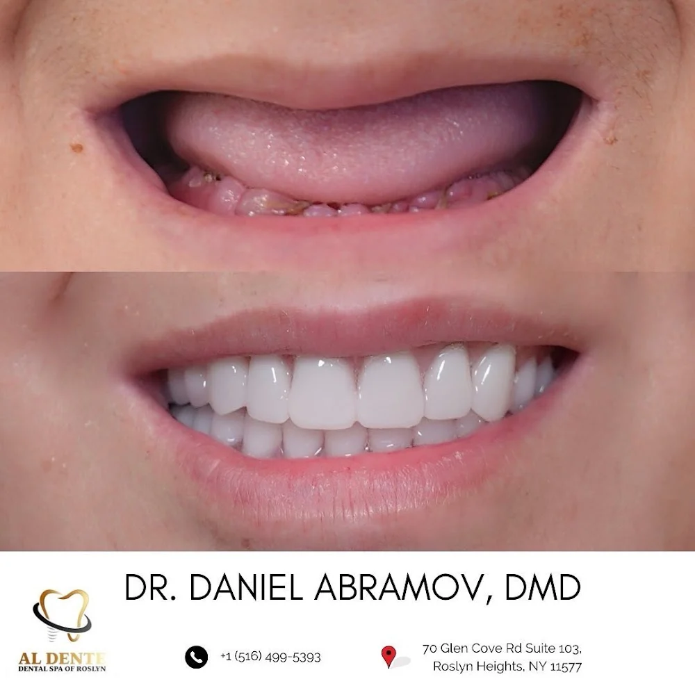 AL Dente Dental Spa of Roslyn - Dr. Edward Shalomov & Dr. Daniel Abramov 6