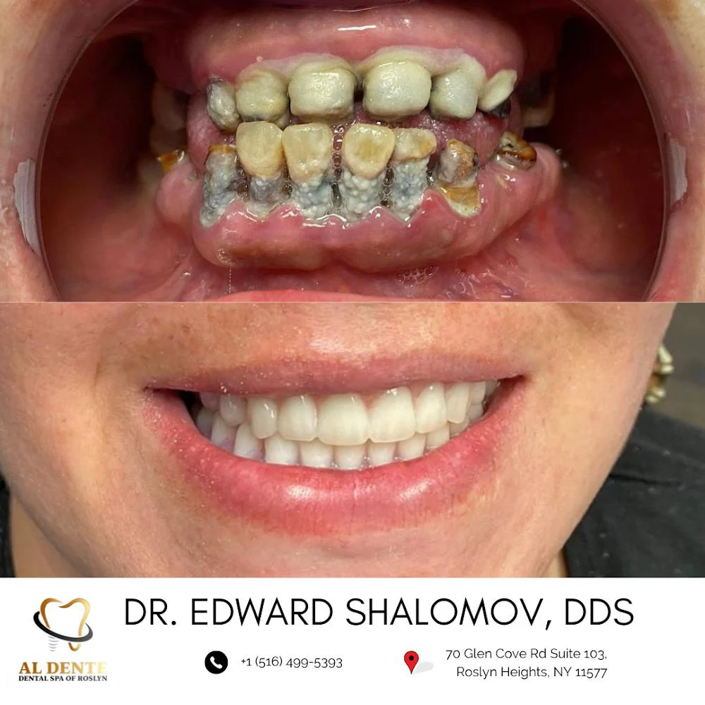 AL Dente Dental Spa of Roslyn - Dr. Edward Shalomov & Dr. Daniel Abramov 5