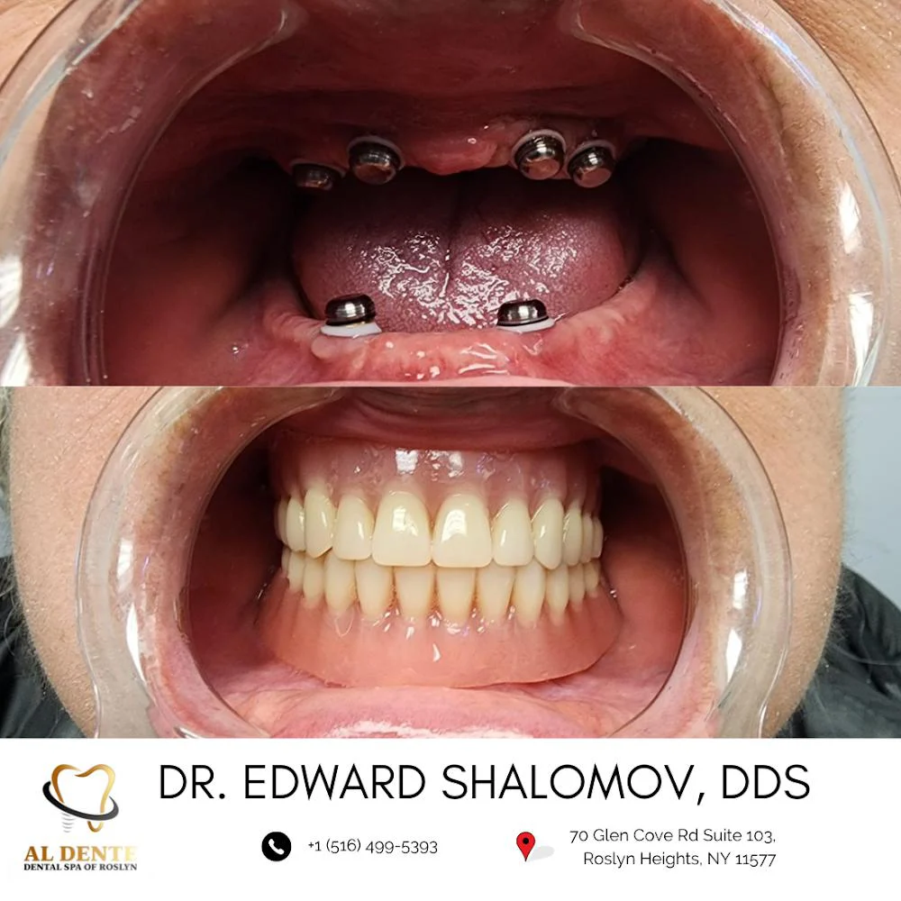 AL Dente Dental Spa of Roslyn - Dr. Edward Shalomov & Dr. Daniel Abramov 7