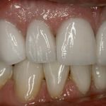 Gold Dust Dental Lab