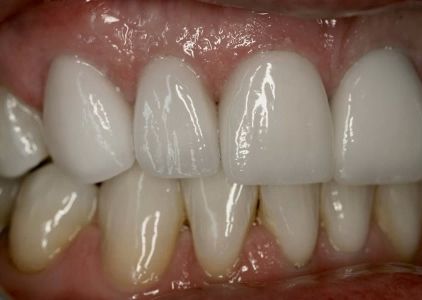 Gold Dust Dental Lab