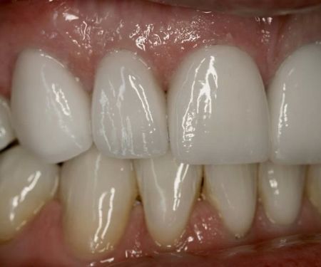 Gold Dust Dental Lab