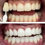 Image Plus Dental