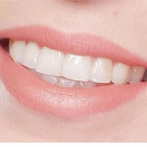Capstone Dental Care 1