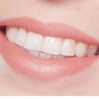 Capstone Dental Care ico