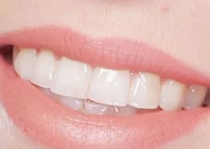 Capstone Dental Care